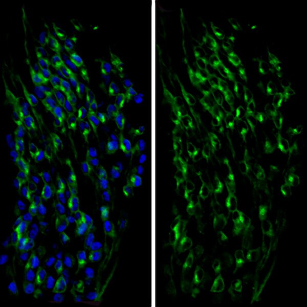 TRKC expression in E11.5 ISL1+ DRG neurons using DSHB antibody 39.4D5 anti-Islet-1 & Islet-2 homeobox (blue). PMID: 31515492, Fig 1E.